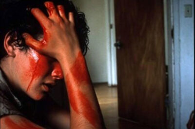 My Parents Locked Me Out At 2AM—Nurse Said ‘Those Aren’t Burns From Falling Down Stairs…